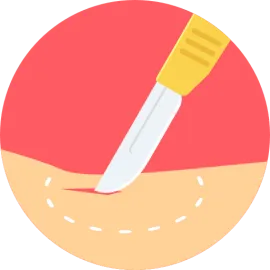 Surgery